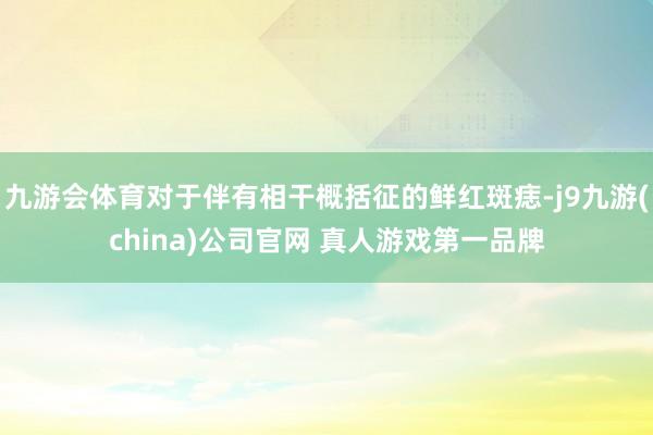九游会体育对于伴有相干概括征的鲜红斑痣-j9九游(china)公司官网 真人游戏第一品牌